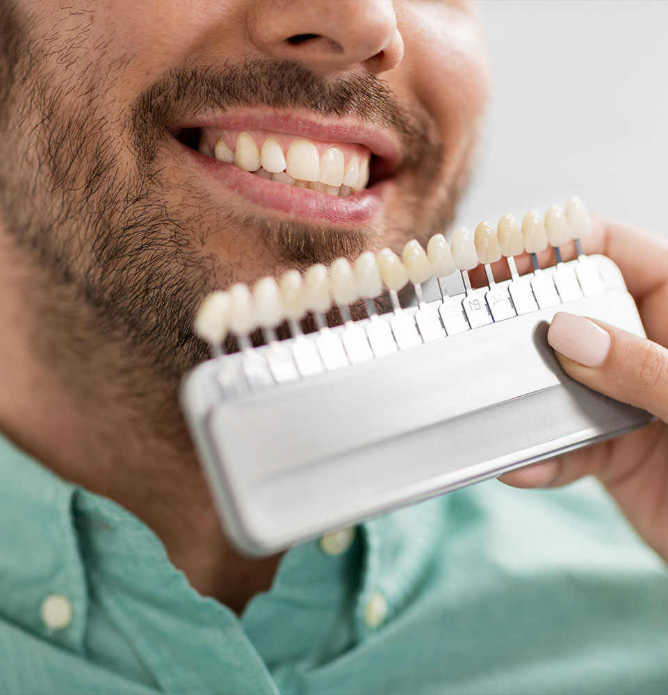 close up of patient have veneers being compared