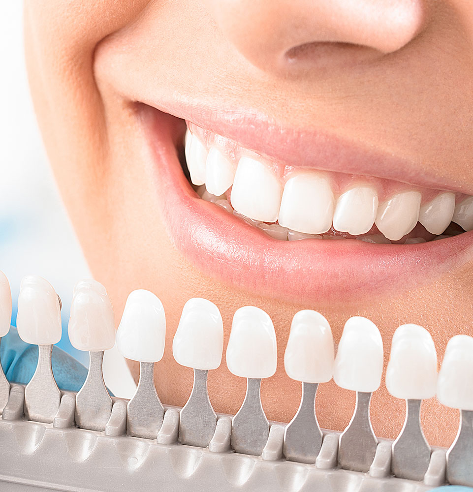 close up of different whitening scales