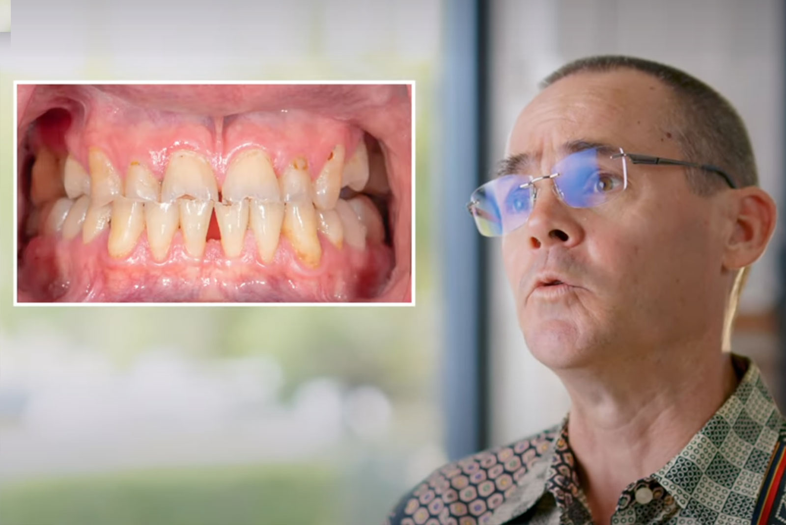 Eric patient thumbnail