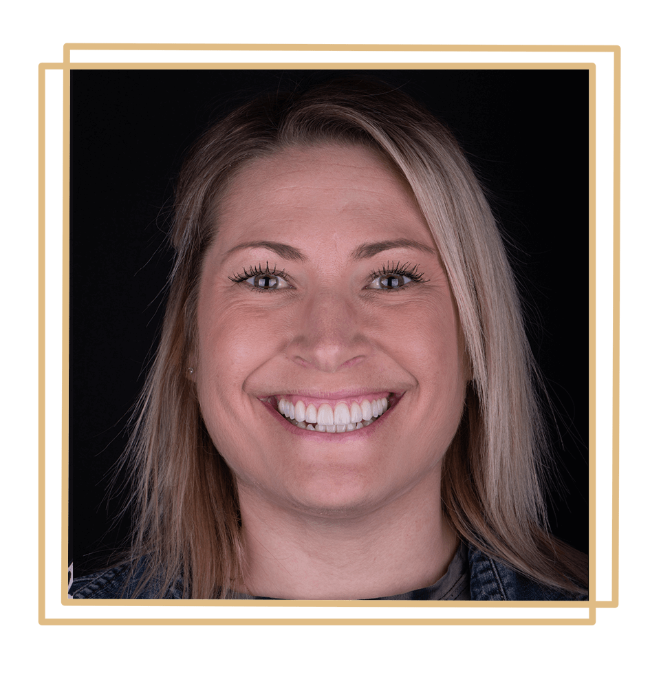 veneers patient