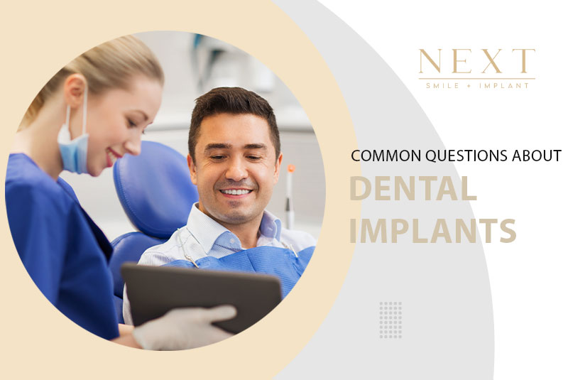 Common Questions About Dental Implant Procedures