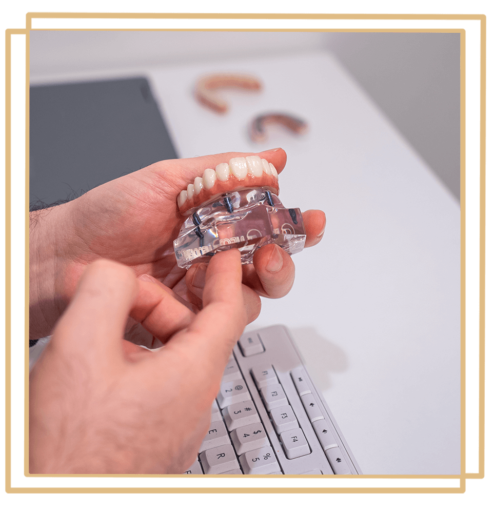 doctor holding full arch implants